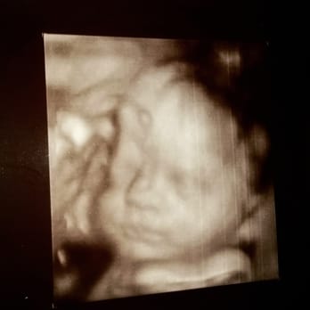 Before the Stork 4D - Ultrasound Imaging Centers Near Me - Anaheim, California