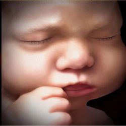 Exceptional Imaging Center - 5D Ultrasound