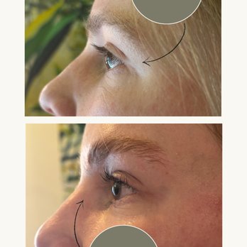 Pure Dermal Care - Lash Lift and Brow Lamination - Skin Care Near Me - Arvada, Colorado Pure Dermal Care - Lash Lift and Brow Lamination - Skin Care Near Me - Arvada, Colorado