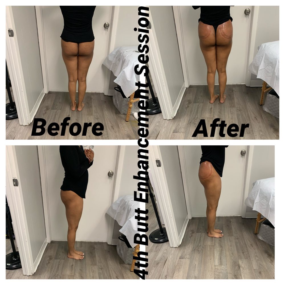 QUEEN DIVAS BODY SCULPTING Updated October 2024 49 Photos 1040