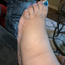 Queen Nails & Spa - My Foot once I came home from the salon