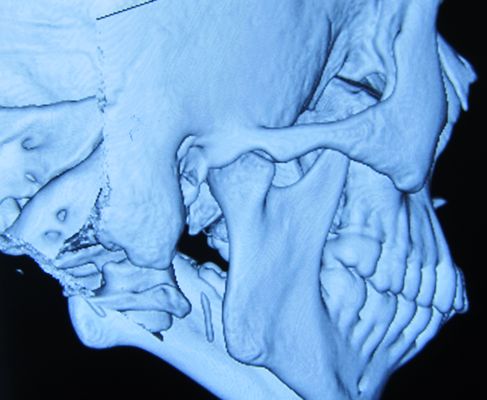 ADVANCED TMJ MAXILLOFACIAL PAIN & SLEEP CENTER - Updated July 2026 - 18 ...