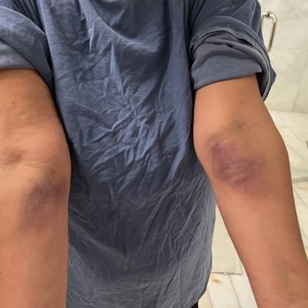 LABCORP - Updated April 2025 - 28 Photos & 43 Reviews - 400 Arthur ...