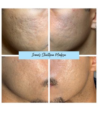 Irene's Skintopia on Yelp