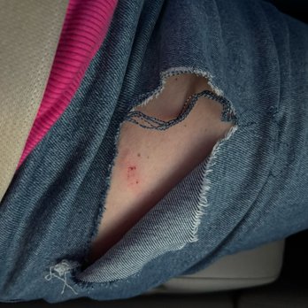 Pie Tap Pizza + Rotisserie + Bar - My ripped jeans and scratched leg. - Pizza Near Me - Frisco, Texas Pie Tap Pizza + Rotisserie + Bar - My ripped jeans and scratched leg. - Pizza Near Me - Frisco, Texas