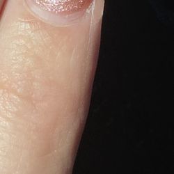Brand new fill after I left. All fingers looked like this. Looks like a week or two growth.