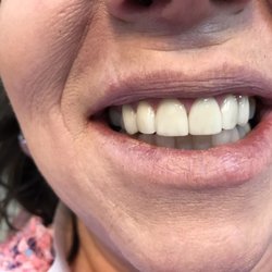 Family Dentistry- Jacob Stein, DMD - After