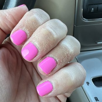 Essentials Massage & Facials of Brandon - Peeling fingertips and cut cuticle... - Skin Care Near Me - Brandon, Florida