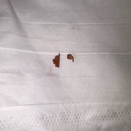 This was in the cake and I had to take it out of my mouth.