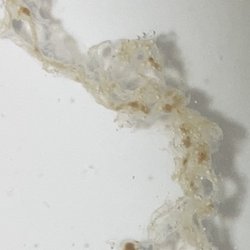 Colon and Rectal Clinic - Who knows, but images were shown prior to surgery being performed so obviously the doctor doesn't care either