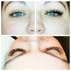 MY Skin Care & Electrolysis - Xtreme lashes