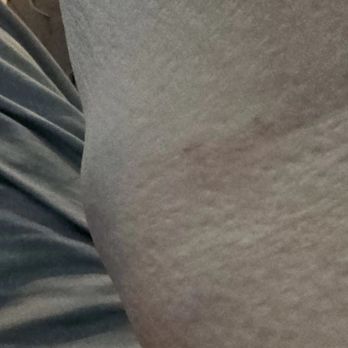 Diagnostic Laboratory Services - Blood was drawn at 855am, and the swelling and discomfort started at 1139am - Diagnostic Services Near Me - Kailua, Hawaii Diagnostic Laboratory Services - Blood was drawn at 855am, and the swelling and discomfort started at 1139am - Diagnostic Services Near Me - Kailua, Hawaii