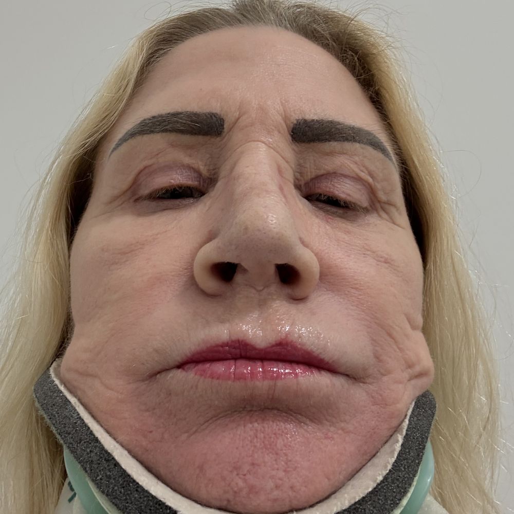 Blue Illusion Beauty - Nostrils now - Medical Spas Near Me - Carlsbad, California Blue Illusion Beauty - Nostrils now - Medical Spas Near Me - Carlsbad, California