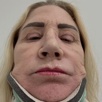 Blue Illusion Beauty - Nostrils now - Medical Spas Near Me - Carlsbad, California Blue Illusion Beauty - Nostrils now - Medical Spas Near Me - Carlsbad, California