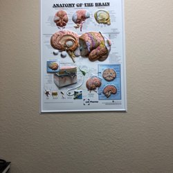 Devanshi Gupta, MD - North Texas Neurology & Neuropathy - Poster of the anatomy of the