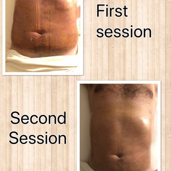 Body Tour & Conturing - Lymphatic drainage massage post-op - Body Contouring Near Me - Tomball, Texas Body Tour & Conturing - Lymphatic drainage massage post-op - Body Contouring Near Me - Tomball, Texas