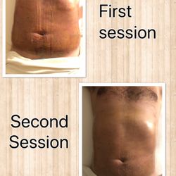 Body Tour & Conturing - Lymphatic drainage massage post-op