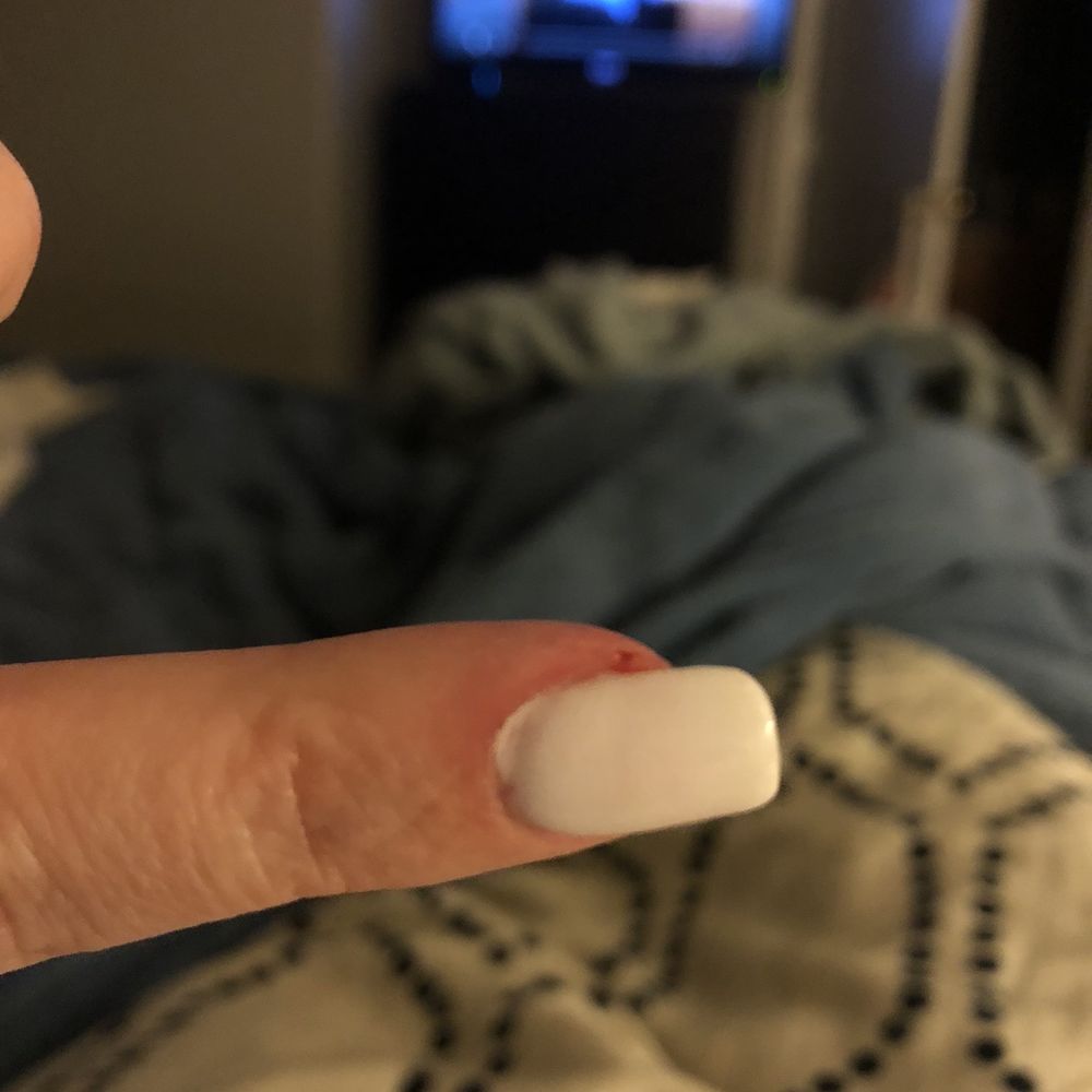 Charming Nails - Bleeding and painful - Nail Salons Near Me - Las Vegas, Nevada