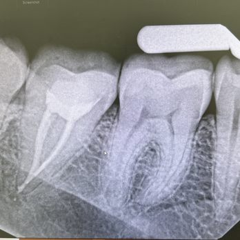 Elite Dental Group - Cosmetic Dentists Near Me - Granada hills, California