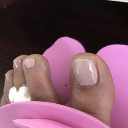 Nail polish on skin. Uneven application and horrendous cuticle job Nail polish on skin. Uneven application and horrendous cuticle job