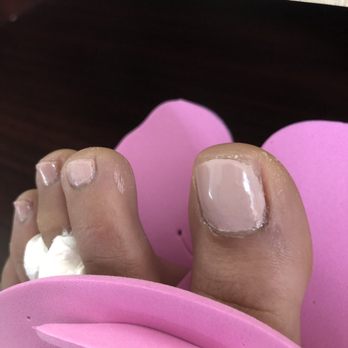 Solar Nails - Nail polish on skin. Uneven application and horrendous cuticle job - Nail Salons Near Me - Sandy Springs, Georgia Solar Nails - Nail polish on skin. Uneven application and horrendous cuticle job - Nail Salons Near Me - Sandy Springs, Georgia