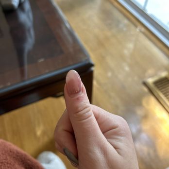 Thistle - Sliced my finger while opening sharp plastic container. - Food Delivery Services Near Me Thistle - Sliced my finger while opening sharp plastic container. - Food Delivery Services Near Me