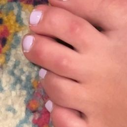 Yesterdays pedicure - one day old Yesterdays pedicure - one day old
