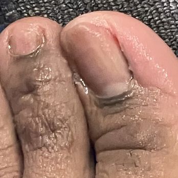 Swan Nails - The tech named Hana cut too much skin off my big toe and proceeded to wipe the blood off and pour ointment on it. - Nail Salons Near Me - Las Vegas, Nevada Swan Nails - The tech named Hana cut too much skin off my big toe and proceeded to wipe the blood off and pour ointment on it. - Nail Salons Near Me - Las Vegas, Nevada