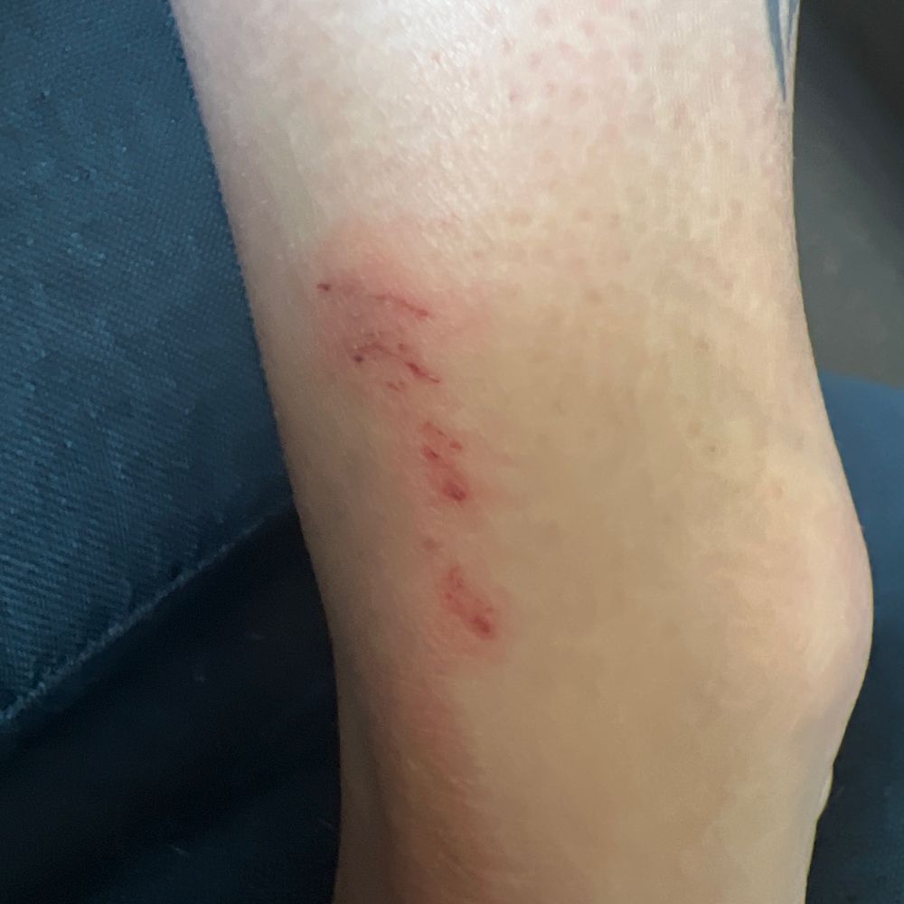 A scratch from the husband.