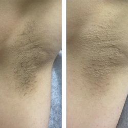 Snatchedandwaxed - Underarm wax