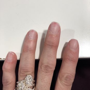 Marina Nails Spa - The damage caused on the top of my nails from removing the CND polish - Nail Salons Near Me - Venice, California