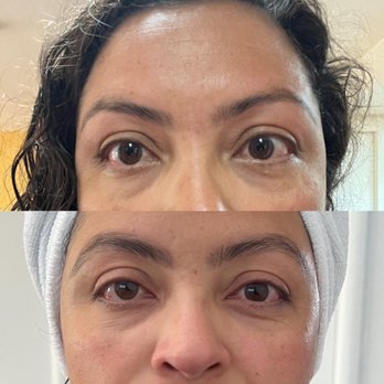 Salon Aphrodite - Below picture is the first visit- loved my eyebrows The top picture was today 6/25 - - Waxing Near Me - Albany, California Salon Aphrodite - Below picture is the first visit- loved my eyebrows The top picture was today 6/25 - - Waxing Near Me - Albany, California