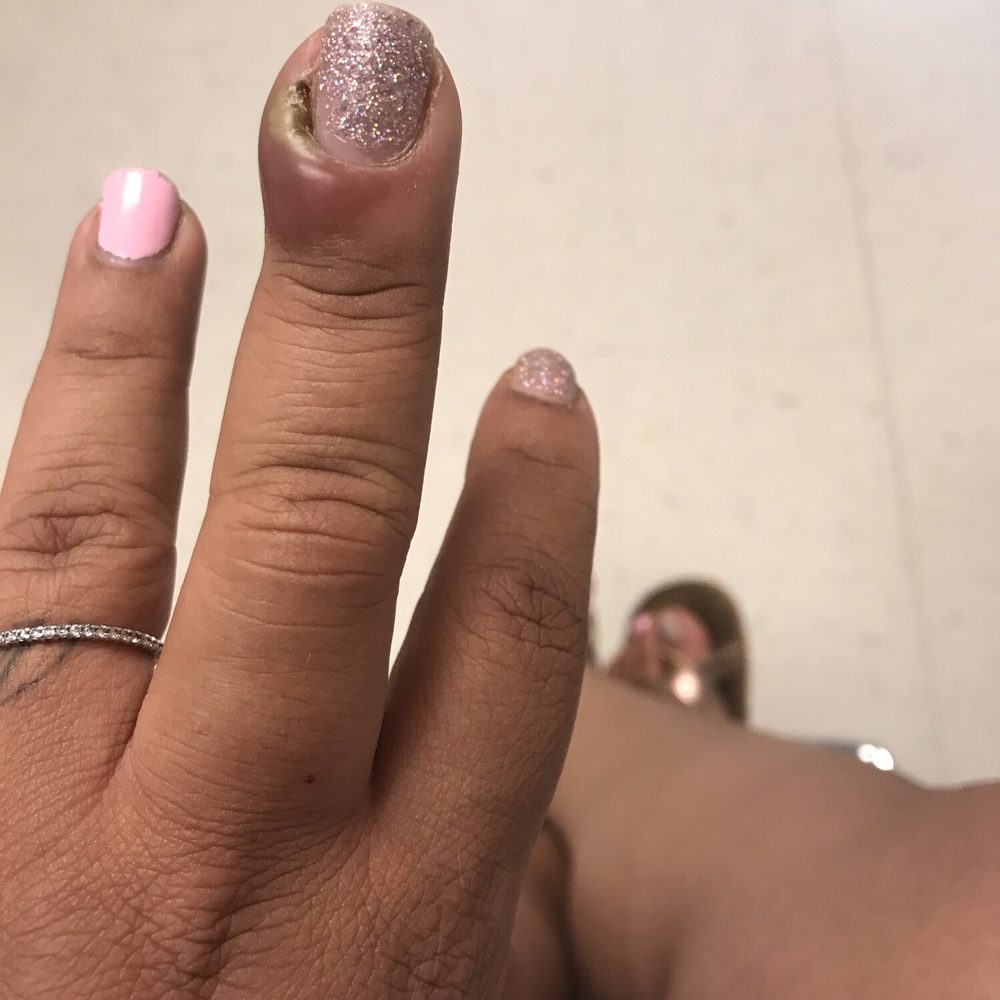 Went for a mani/pedi, ended up with an ingrown fingernail that required a visit to Patient First for lancing and antibiotics. Went for a mani/pedi, ended up with an ingrown fingernail that required a visit to Patient First for lancing and antibiotics.