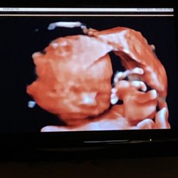 Sinai Perinatal - Awesome tech showed me my beautiful baby boy, I wasn't expecting that and I so appreciated it!