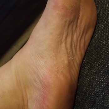 Monaco Nails - Had callus remover and this is my foot an hour after pedi. - Nail Salons Near Me - Goodyear, Arizona