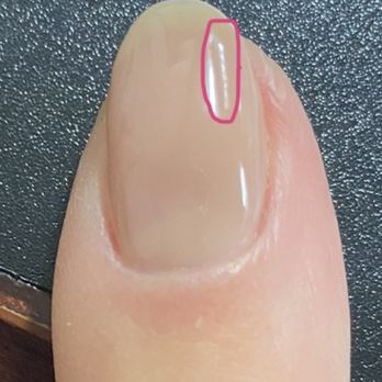 Solo Nails - Missing gel top coat. There is a streak - Nail Salons Near Me - Los Angeles, California Solo Nails - Missing gel top coat. There is a streak - Nail Salons Near Me - Los Angeles, California