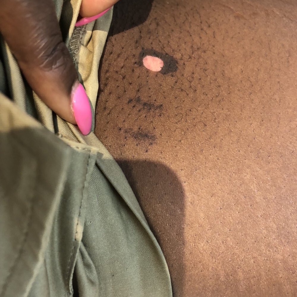 Bared Monkey Laser Spa - Laser Hair Removal Near Me - New York, New York Bared Monkey Laser Spa - Laser Hair Removal Near Me - New York, New York