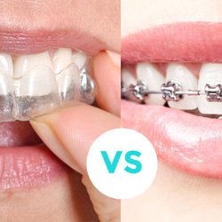 Advanced Dental Care - FREE Braces or Invisalign Consultation
