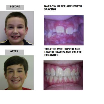Cain Paul J, DDS - Orthodontists Near Me - Brightwaters, New York Cain Paul J, DDS - Orthodontists Near Me - Brightwaters, New York