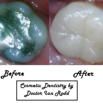 Ian H Rodd, DDS - Cosmetic Dentists Near Me