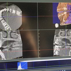 Peak Endodontics - CBCT scan