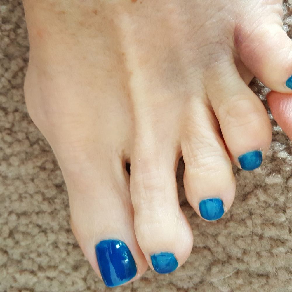Note: broken toes and the pedicure stood up! Note: broken toes and the pedicure stood up!