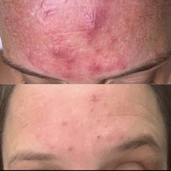 Before (top) after 24hours (below)