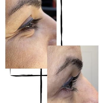 Mila Laser Clinic - Skin Care Near Me - Richmond Hill, Ontario Mila Laser Clinic - Skin Care Near Me - Richmond Hill, Ontario