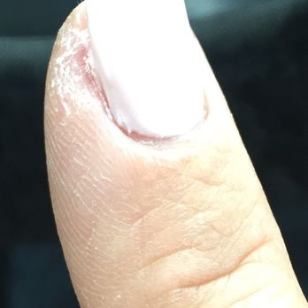 Aloha Nail - Skin is so dry & raw after. - Nail Salons Near Me - Las Vegas, Nevada Aloha Nail - Skin is so dry & raw after. - Nail Salons Near Me - Las Vegas, Nevada