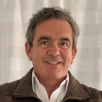 Neopel - 33 months after transplant - Hair Loss Centers Near Me - Tijuana, BCN Neopel - 33 months after transplant - Hair Loss Centers Near Me - Tijuana, BCN