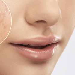 Cecylia Licensed Esthetician