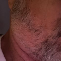 Julian Josef Gents Barber - Damaged Beard