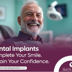Spreckels Park Dental - What are dental implants?
Dental implants are small titanium posts that replace the roots of missing teeth...