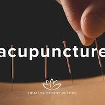 Excel Therapy - Acupuncture! - Physical Therapy Near Me - Villa Park, Illinois Excel Therapy - Acupuncture! - Physical Therapy Near Me - Villa Park, Illinois